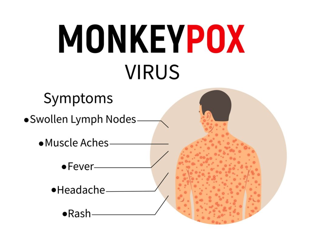 Monkeypox (Mpox) Symptoms, Treatment